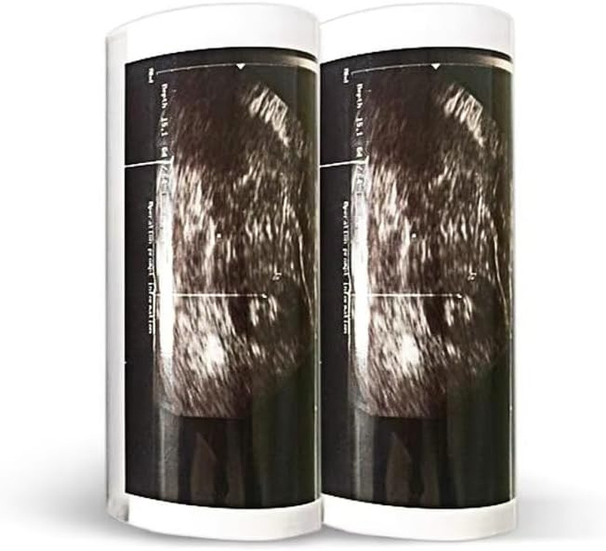 UPP-110HG Ultrasound Thermal Paper, High Gloss 110 Film for Sony/Mitsubishi Prin