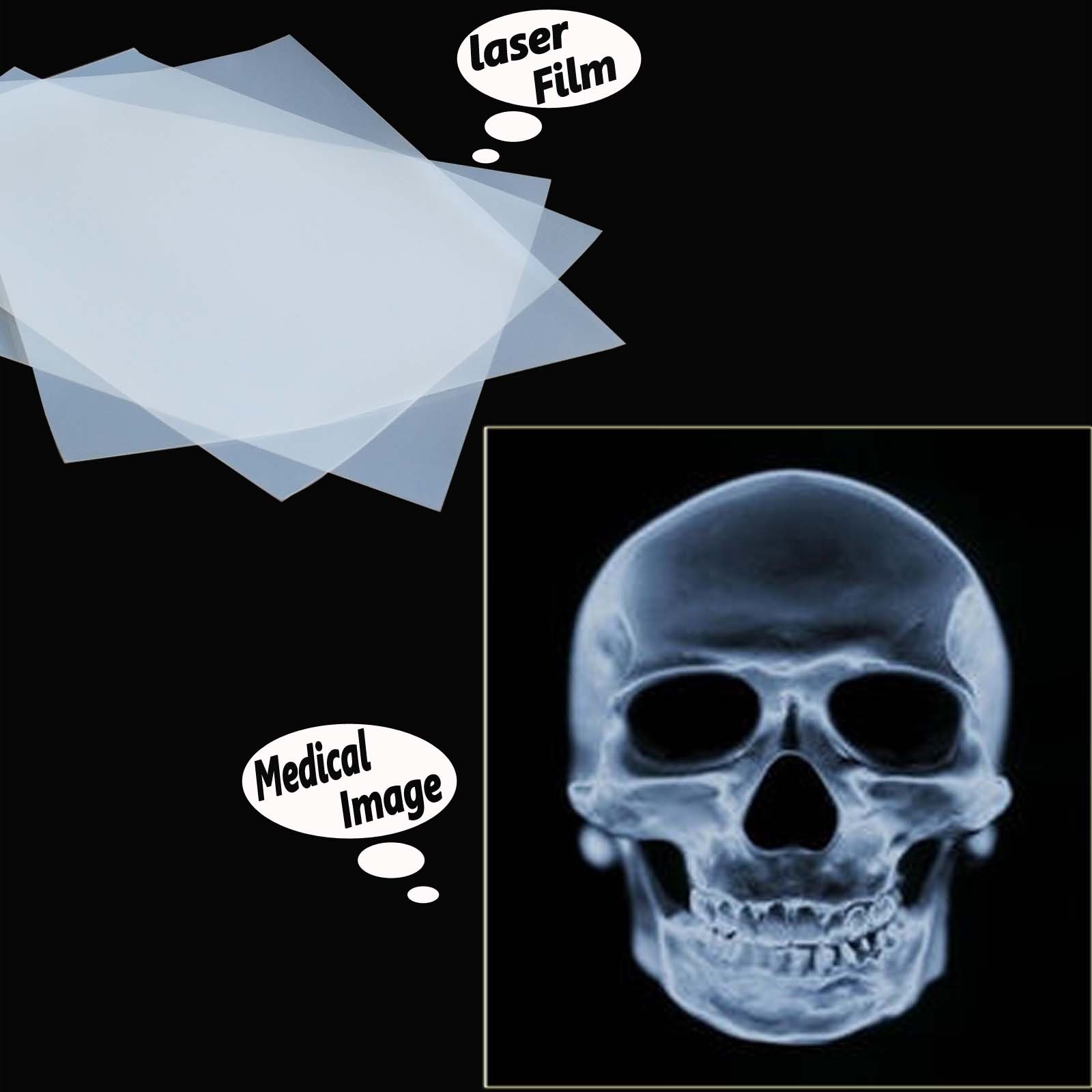 11″ x 17″，100 Sheets，Silk Screen Printing Milky Transparency Laser Printer Film